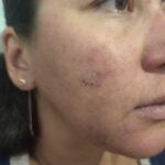 Чистка кишечника для чистой и сияющей кожи: полное руководство