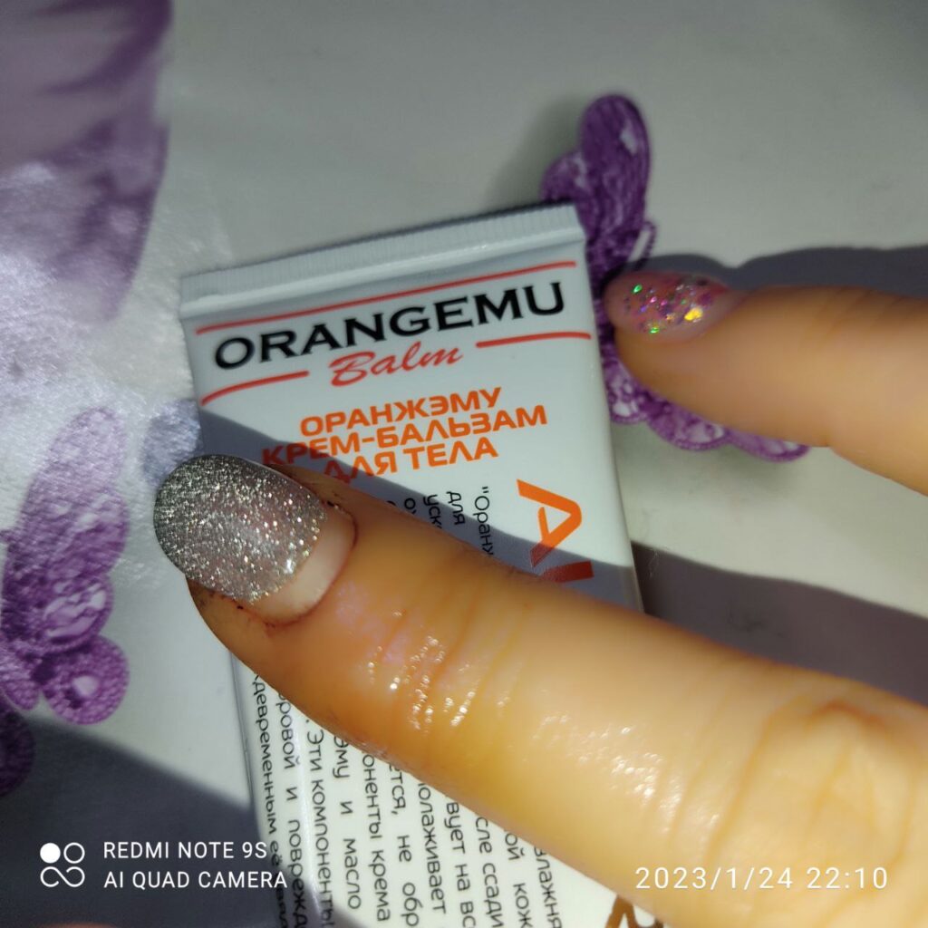 Крем ORANGEMU: Реальный опыт заживления ожога