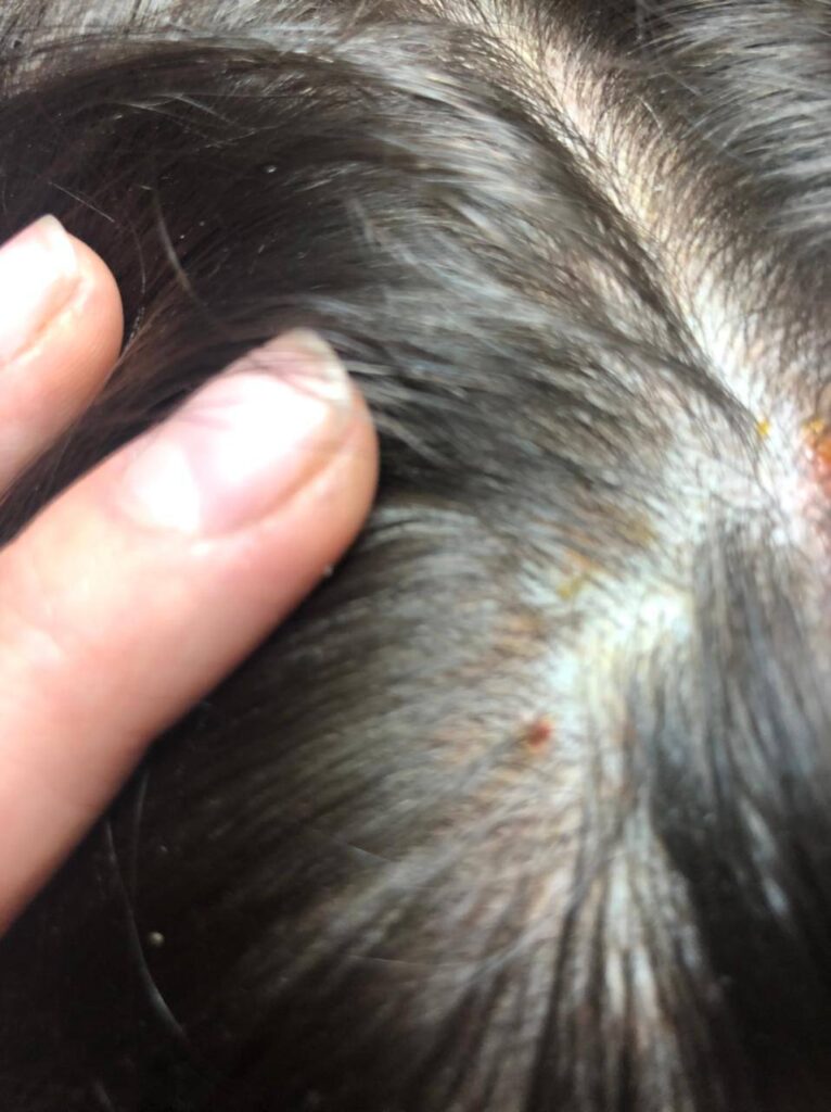 Шампунь Симбад: Реальный Отзыв о Решении Проблемы Перхоти и Зуда